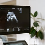 Should I Get a 2D, 3D or 4D Ultrasound?